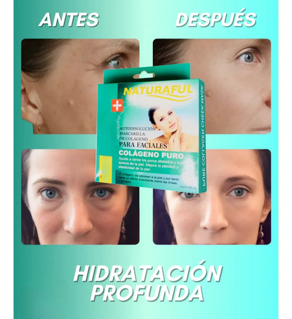 Pack 2 cajas mascarillas de colágeno para la frente